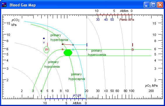 Blood Gas Interpretation Chart